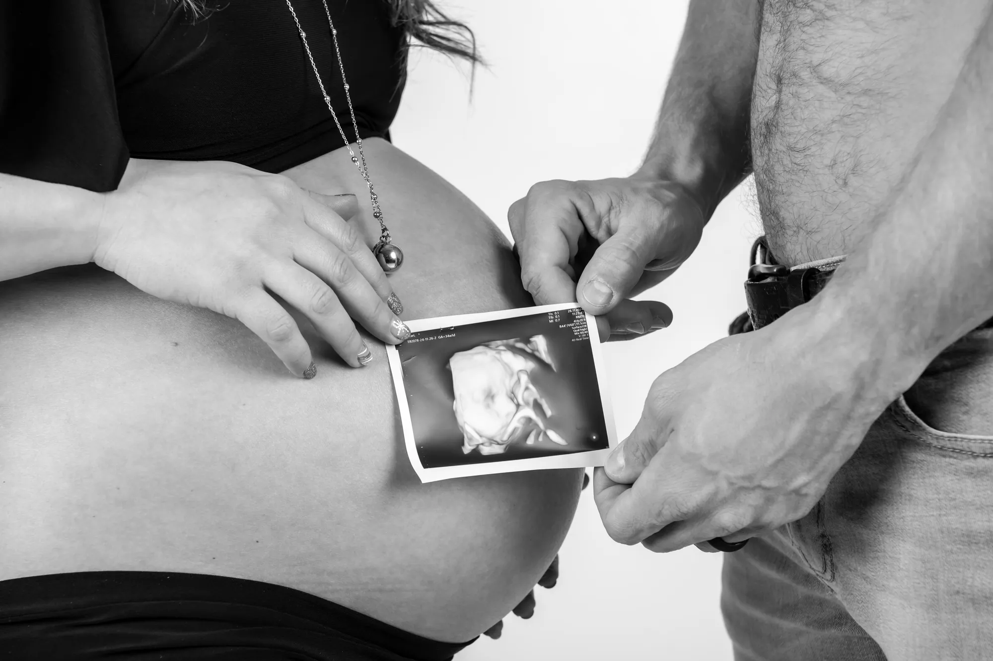 Gravidanza, Studio Frau Fotografia